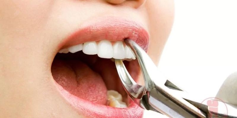 Ý nghĩa của các con số dựa vào người nhổ răng